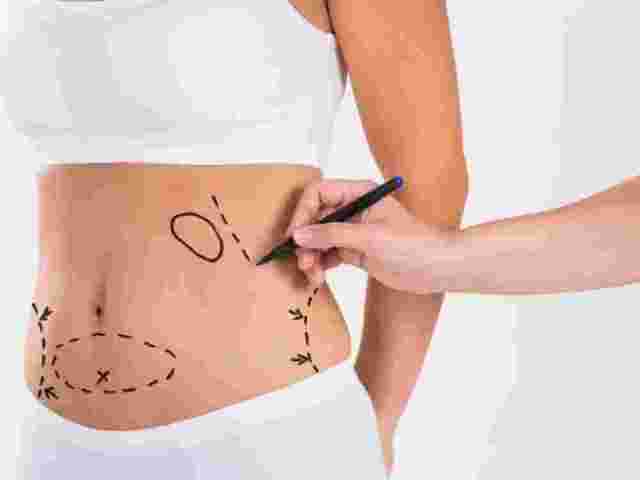 liposuction-surgery-in-andheri-remove-stubborn-fat-effectively