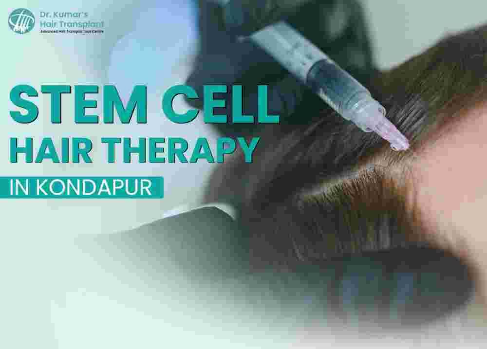 dr-kumars-hair-care-clinic-trusted-stem-cell-hair-therapy-big-0