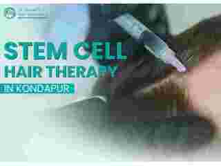 dr-kumars-hair-care-clinic-trusted-stem-cell-hair-therapy-small-0