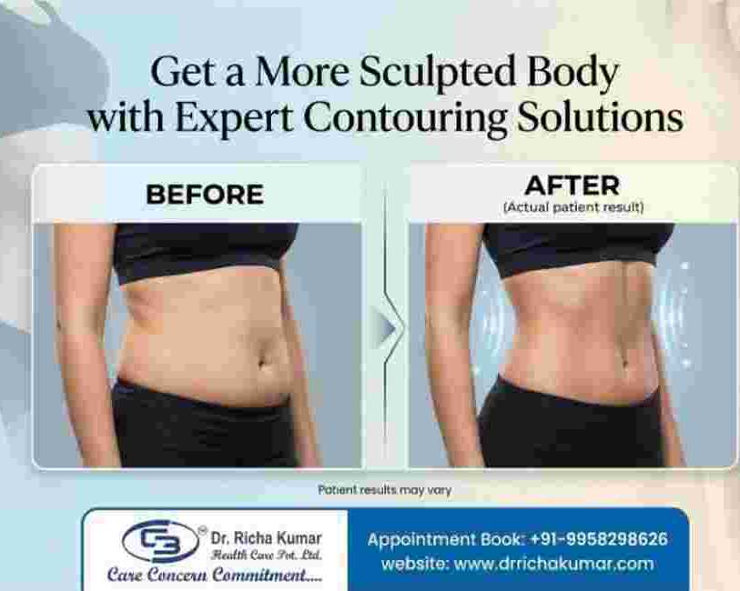 get-a-more-sculpted-body-with-expert-contouring-solutions