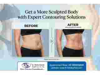get-a-more-sculpted-body-with-expert-contouring-solutions-small-0