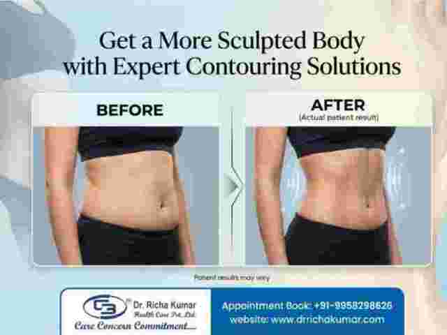 get-a-more-sculpted-body-with-expert-contouring-solutions