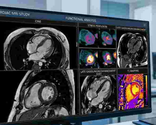 detailed-cardiac-mri-scan-in-mumbai-at-picture-this