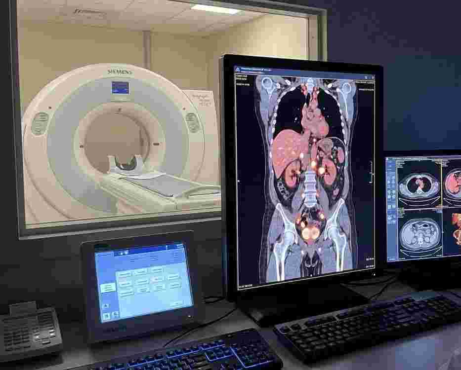 accurate-psma-pet-ct-scan-for-prostate-cancer-at-picture-this-big-0
