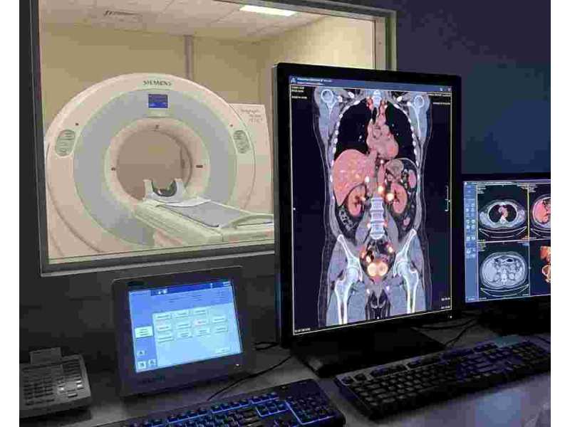 accurate-psma-pet-ct-scan-for-prostate-cancer-at-picture-this-small-0