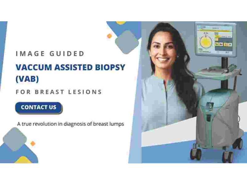 precise-stereotactic-vacuum-assisted-breast-biopsy-small-0