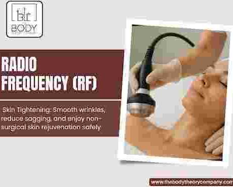 rf-skin-tightening-treatment-for-firm-and-youthful-skin-today