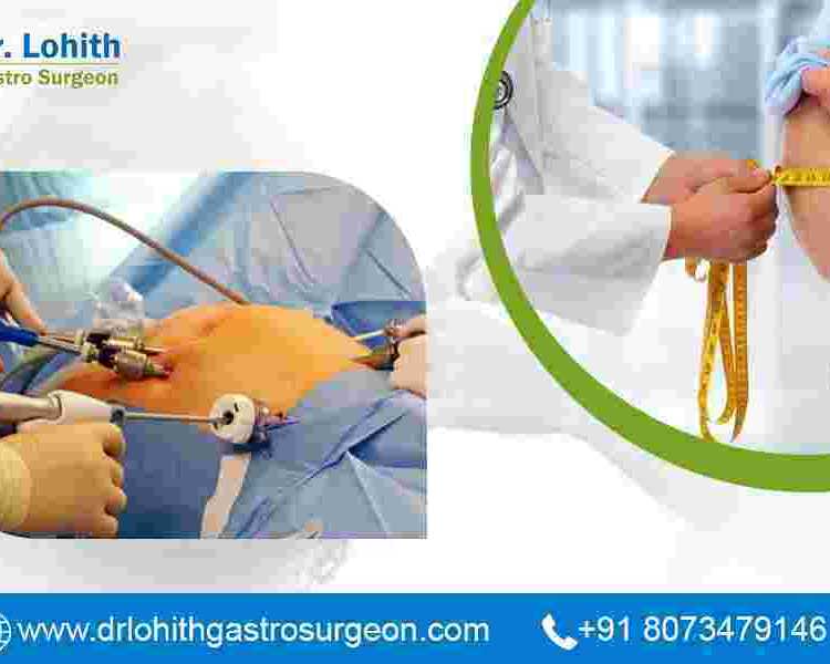 best-bariatric-surgeon-in-bangalore