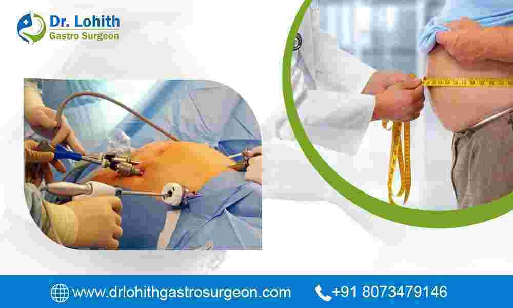 best-bariatric-surgeon-in-bangalore-big-0