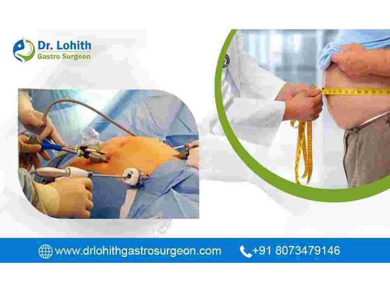 best-bariatric-surgeon-in-bangalore-small-0