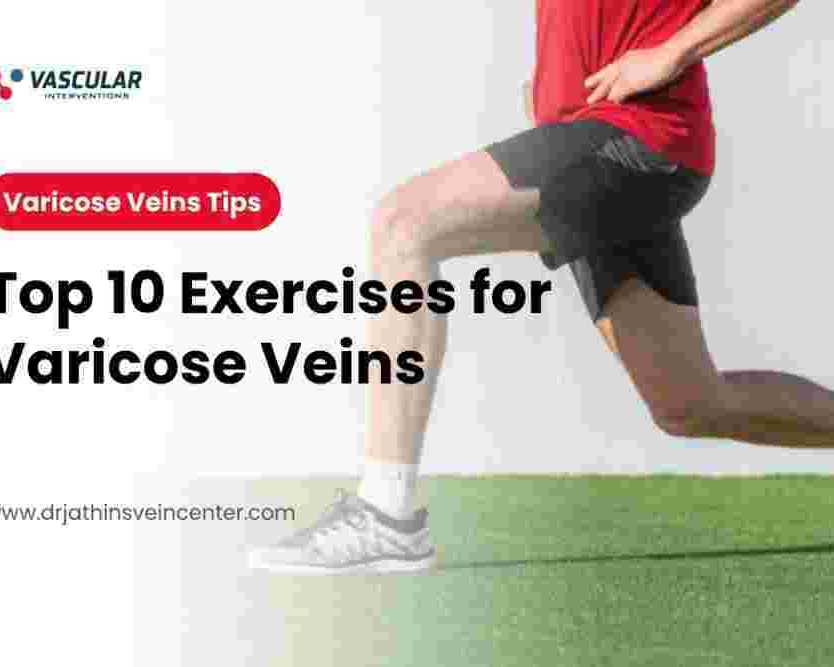 healthy-veins-active-life-10-exercises-you-should-know