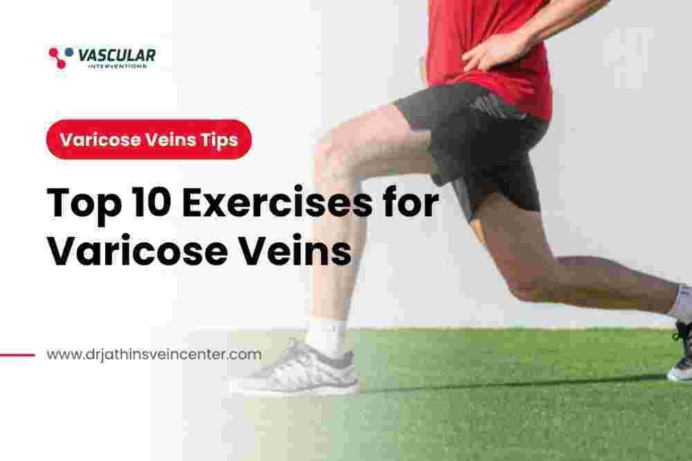 healthy-veins-active-life-10-exercises-you-should-know-big-0