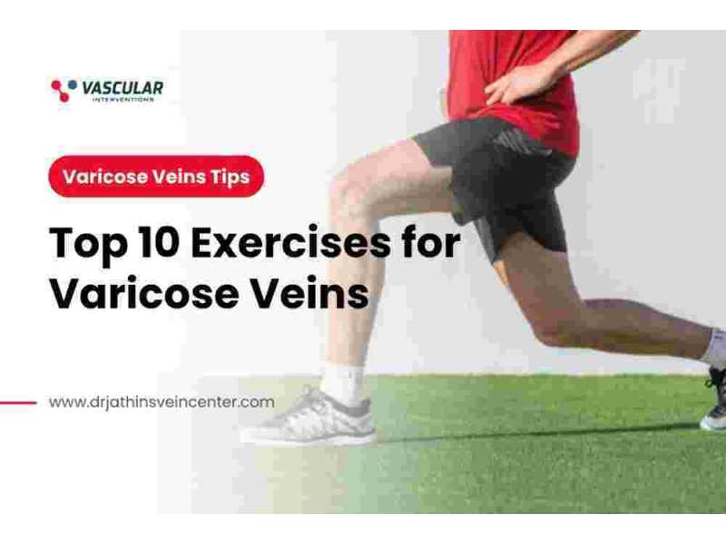 healthy-veins-active-life-10-exercises-you-should-know-small-0