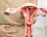 best-uterine-fibroid-embolization-cost-in-india-ufe-treatment