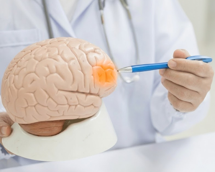 brain-cancer-treatment-in-delhi