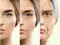 restore-facial-volume-with-the-best-dermal-fillers-in-delhi