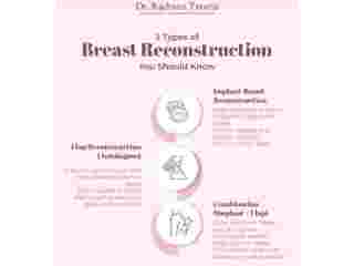 reconstructive-surgeon-mumbai-for-post-mastectomy-care-small-0