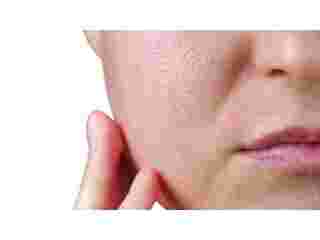 achieve-healthier-skin-with-open-pores-treatment-in-vasant-kunj-small-0