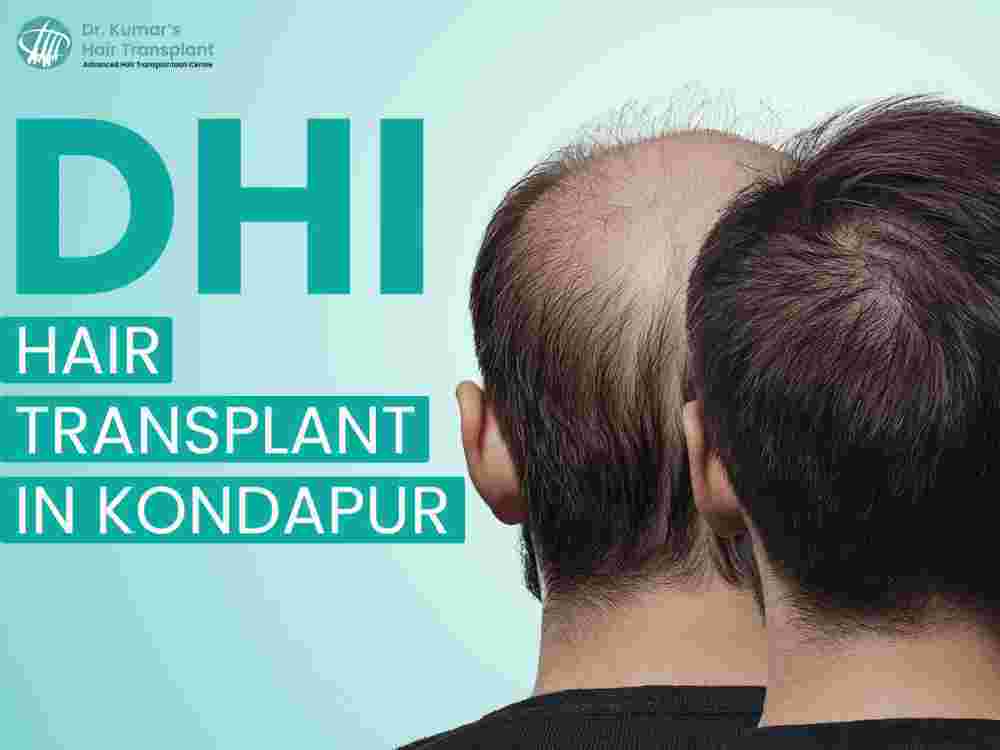 dhi-hair-transplant-you-should-know-before-treatment-big-0