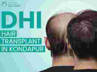 dhi-hair-transplant-you-should-know-before-treatment-small-0