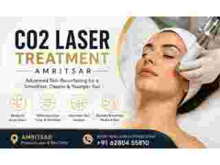 advanced-co2-laser-treatment-amritsar-small-0