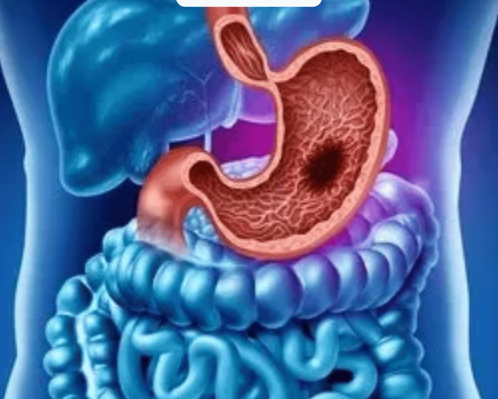 advance-gi-cancer-surgery-with-recovery-and-care-in-ahmedabad