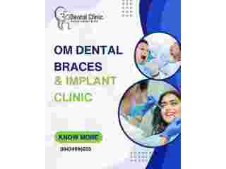 om-dental-braces-implant-clinic-best-dental-clinic-in-patna-small-0
