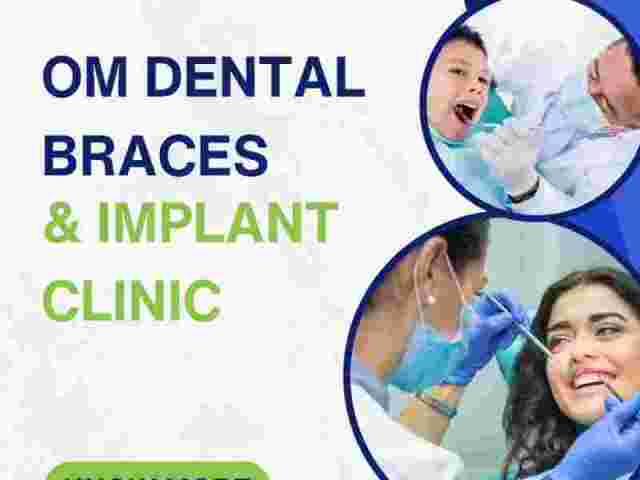 om-dental-braces-implant-clinic-best-dental-clinic-in-patna
