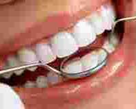 best-dentist-in-chetla-for-healthy-bright-smiles