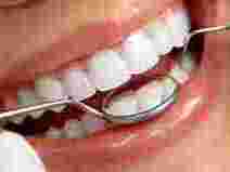 best-dentist-in-chetla-for-healthy-bright-smiles