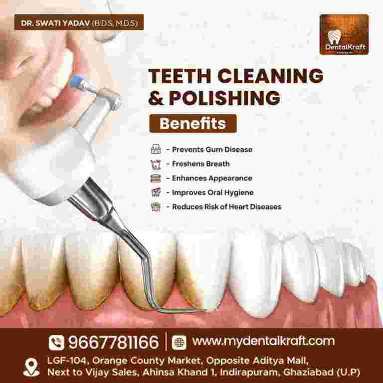 teeth-cleaning-in-indirapuram-for-better-oral-health-big-0