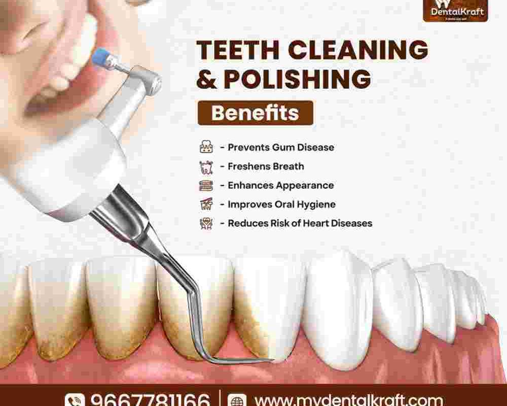 teeth-cleaning-in-indirapuram-for-better-oral-health