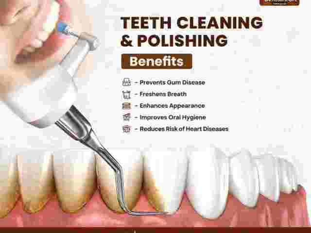 teeth-cleaning-in-indirapuram-for-better-oral-health