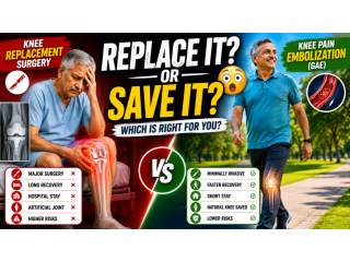knee-pain-embolization-vs-knee-replacement-which-is-right-small-0