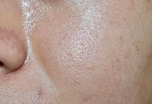 how-to-control-oily-skin-big-0