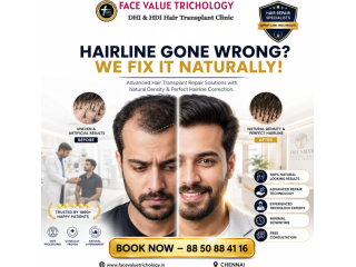 hairline-gone-wrong-we-fix-it-naturally-small-0