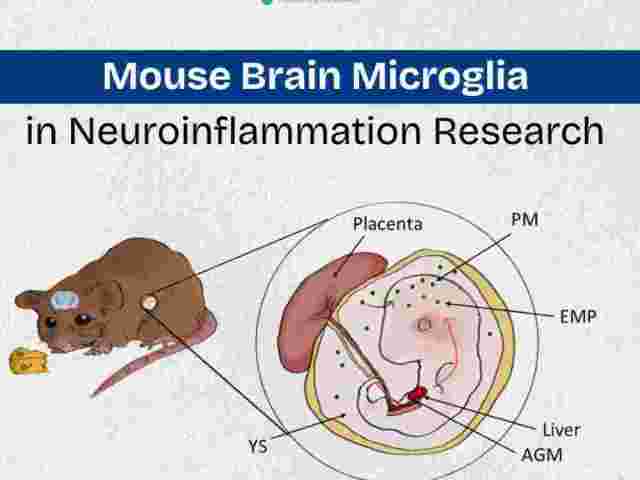 mouse-brain-microglia-in-neuroinflammation-research