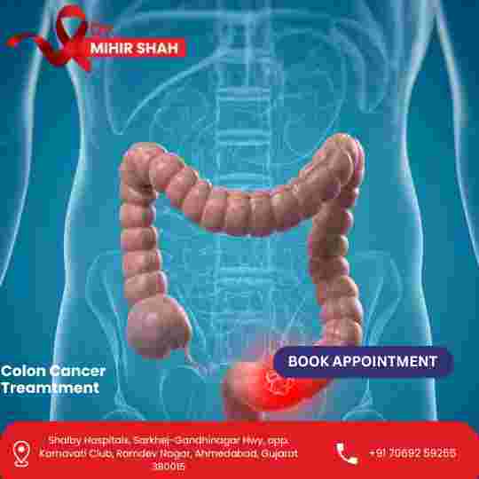 get-the-best-colon-cancer-treatment-in-ahmedabad-for-faster-healing-big-0
