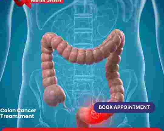 get-the-best-colon-cancer-treatment-in-ahmedabad-for-faster-healing