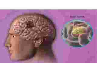 how-can-modern-aesthetic-treatments-improve-skin-confidence-small-0