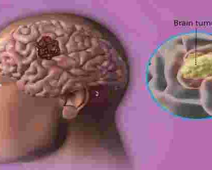 why-is-early-hair-loss-treatment-important-for-better-results
