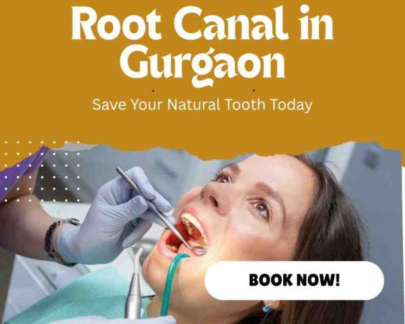 root-canal-in-gurgaon-advanced-painless-treatment-world-of-dentistry
