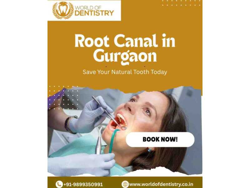 root-canal-in-gurgaon-advanced-painless-treatment-world-of-dentistry-small-0