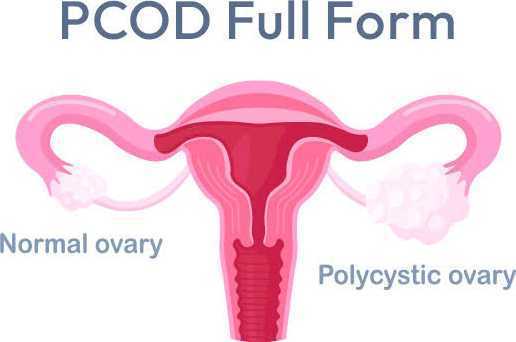 what-lifestyle-changes-can-support-better-pcod-management-big-0