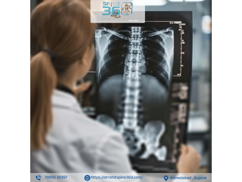 advanced-care-for-complex-spinal-fractures-in-ahmedabad-by-dr-rohit-taker-small-0