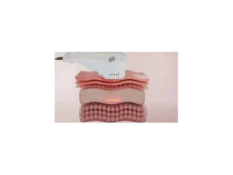 hifu-treatment-in-gurgaon-for-skin-lifting-small-0