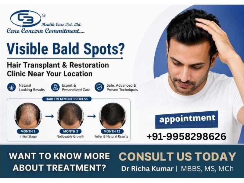 bald-spots-hair-transplant-restoration-clinic-near-you-small-0