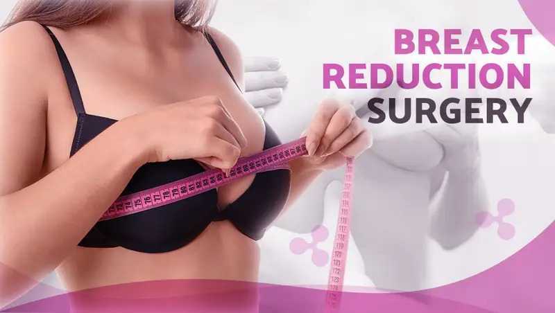 looking-for-breast-reduction-surgery-in-delhi-book-a-consultation-today-big-0