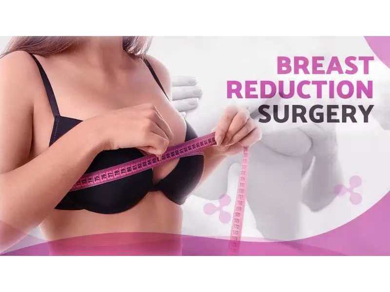 looking-for-breast-reduction-surgery-in-delhi-book-a-consultation-today-small-0