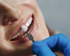 transform-your-smile-at-the-best-dental-implant-clinic-in-chetla
